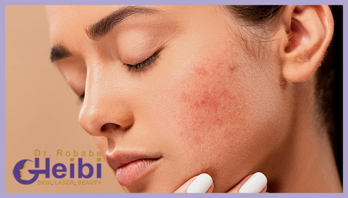 بهترین متخصص پوست و مو