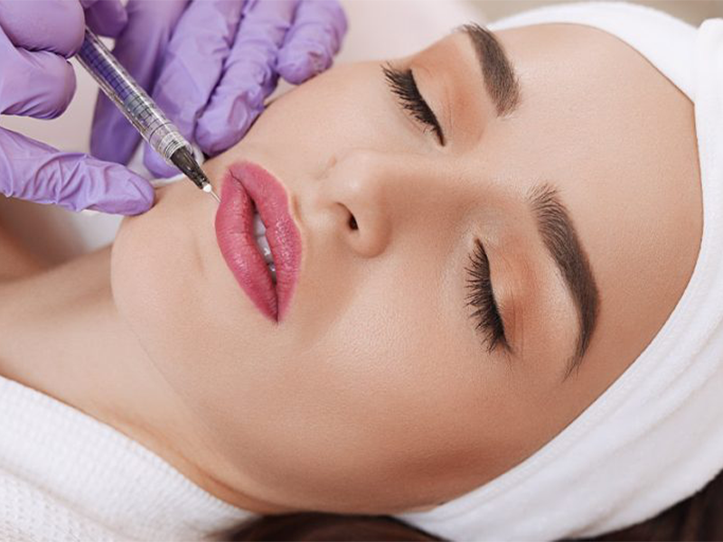 تزریق فیلر خط لبخند