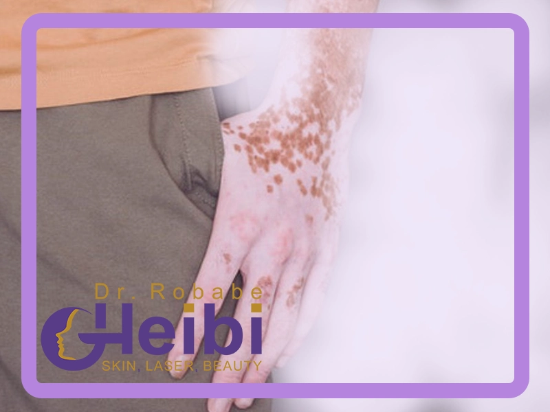 درمان بیماری های پوستی