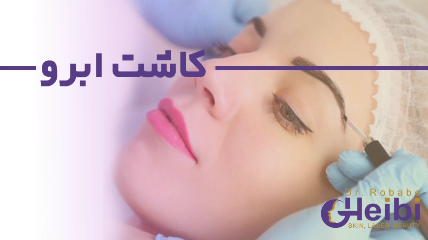 کاشت ابرو