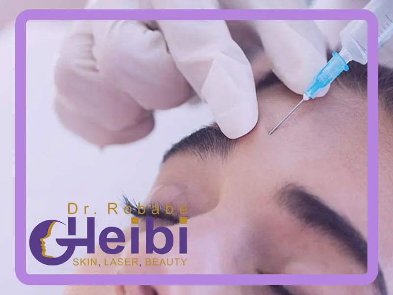 بوتاکس پیشانی