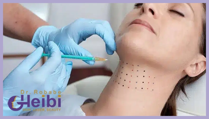 مزایای مزوتراپی غبغب