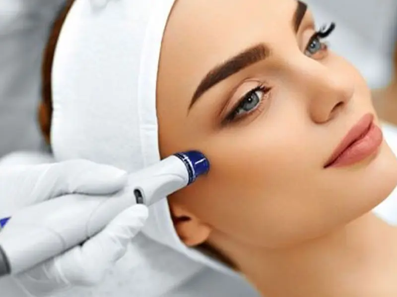 مزایای میکرودرم ابریژن پوست