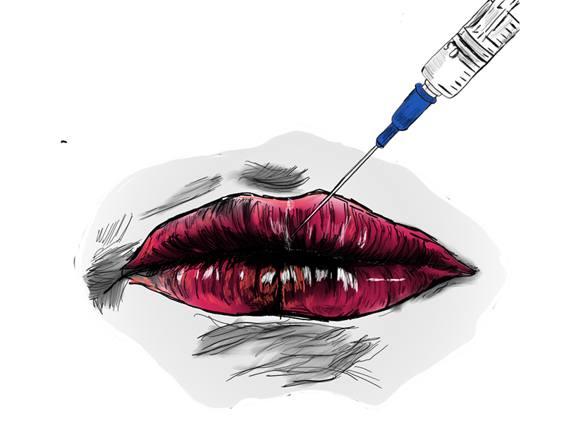 مراقبت بعد از تزریق ژل لب