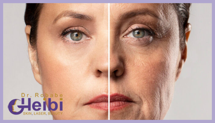 آیا اندولیفت بهتر از هایفو برای جوانسازی صورت است؟