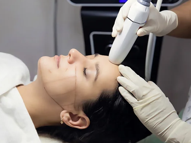 اندولیفت بهتر است یا هایفو؟