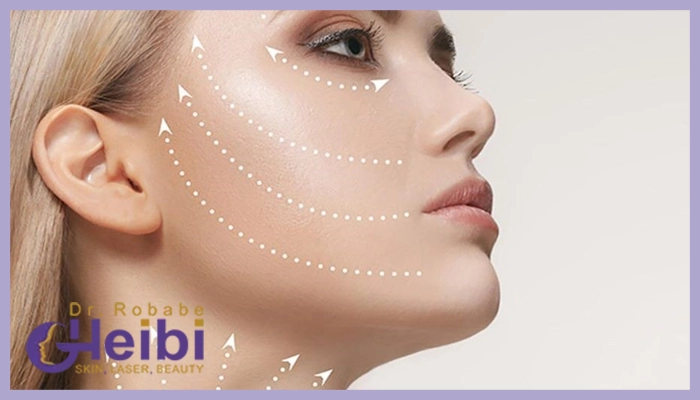 عوامل تاثیر گذار در هزینه اندولیفت صورت