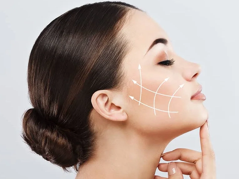 هزینه اندولیفت صورت سال 1404