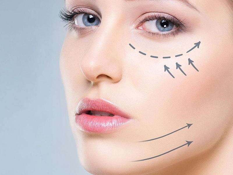 اندولیفت صورت درد دارد؟