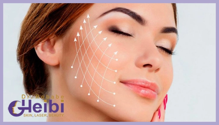 لیفت صورت با نخ