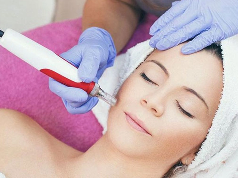 مراقبت‌های بعد از میکرونیدلینگ