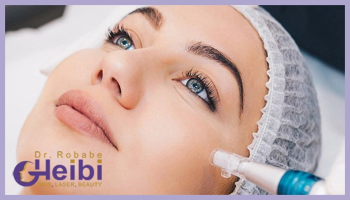 چرا گاهی ماندگاری میکرونیدلینگ کمتر از حد انتظار است؟