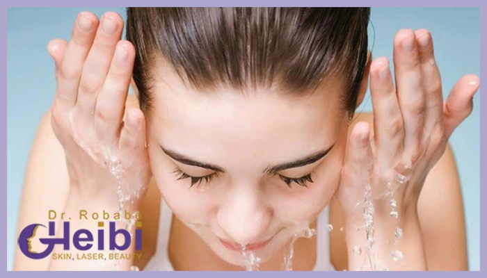 چه مدت بعد از اندولیفت می توان صورت را شست ؟