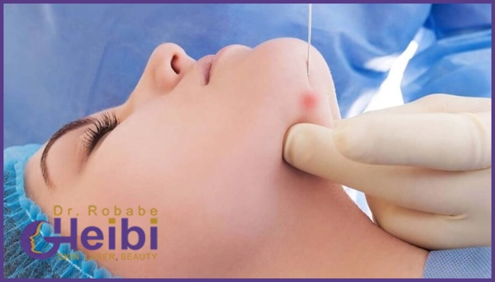 دکتر ربابه غیبی دکتر اندلیفت در ونک