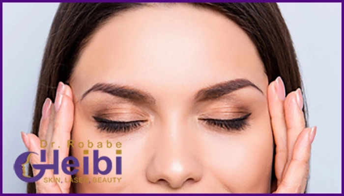 ماندگاری اندولیفت خط اخم چقدر است؟